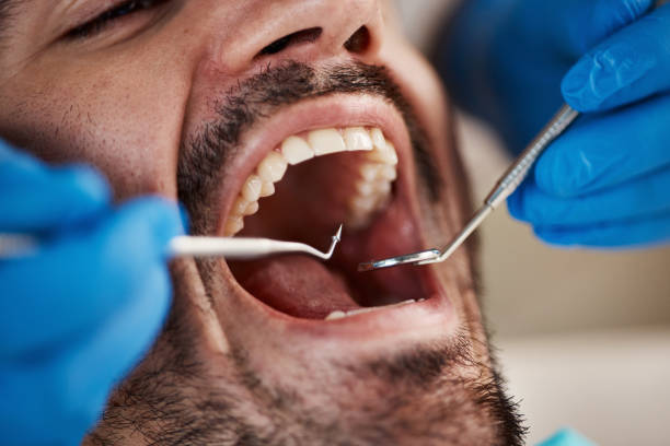 Best Broken or Cracked Tooth Emergency Dentist in Menomonee Falls, WI